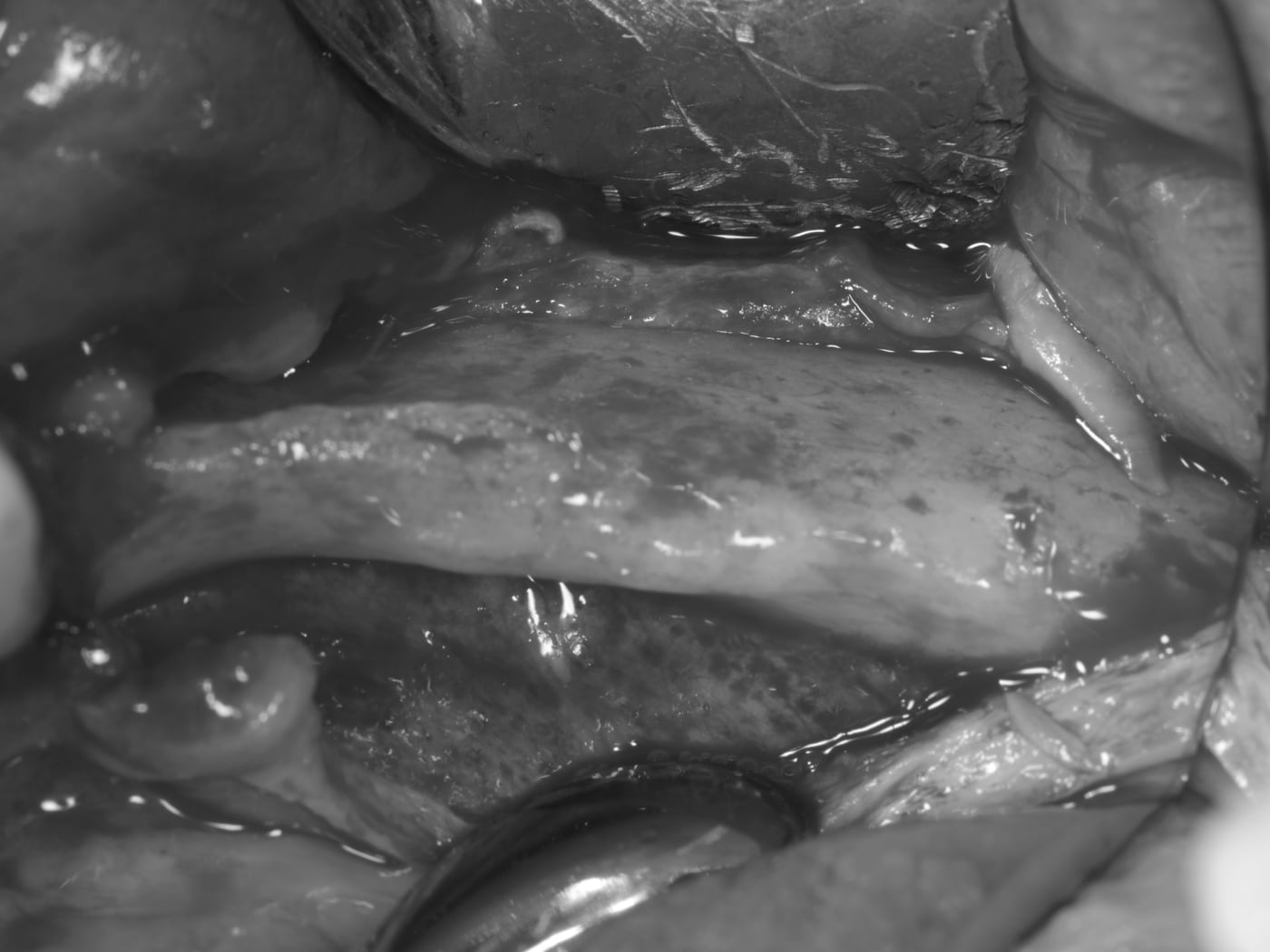 Intra-operative soft-tissue surgical field