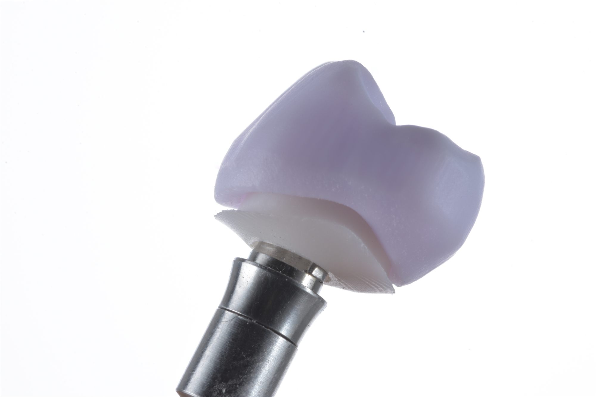 Implant-supported ceramic crown